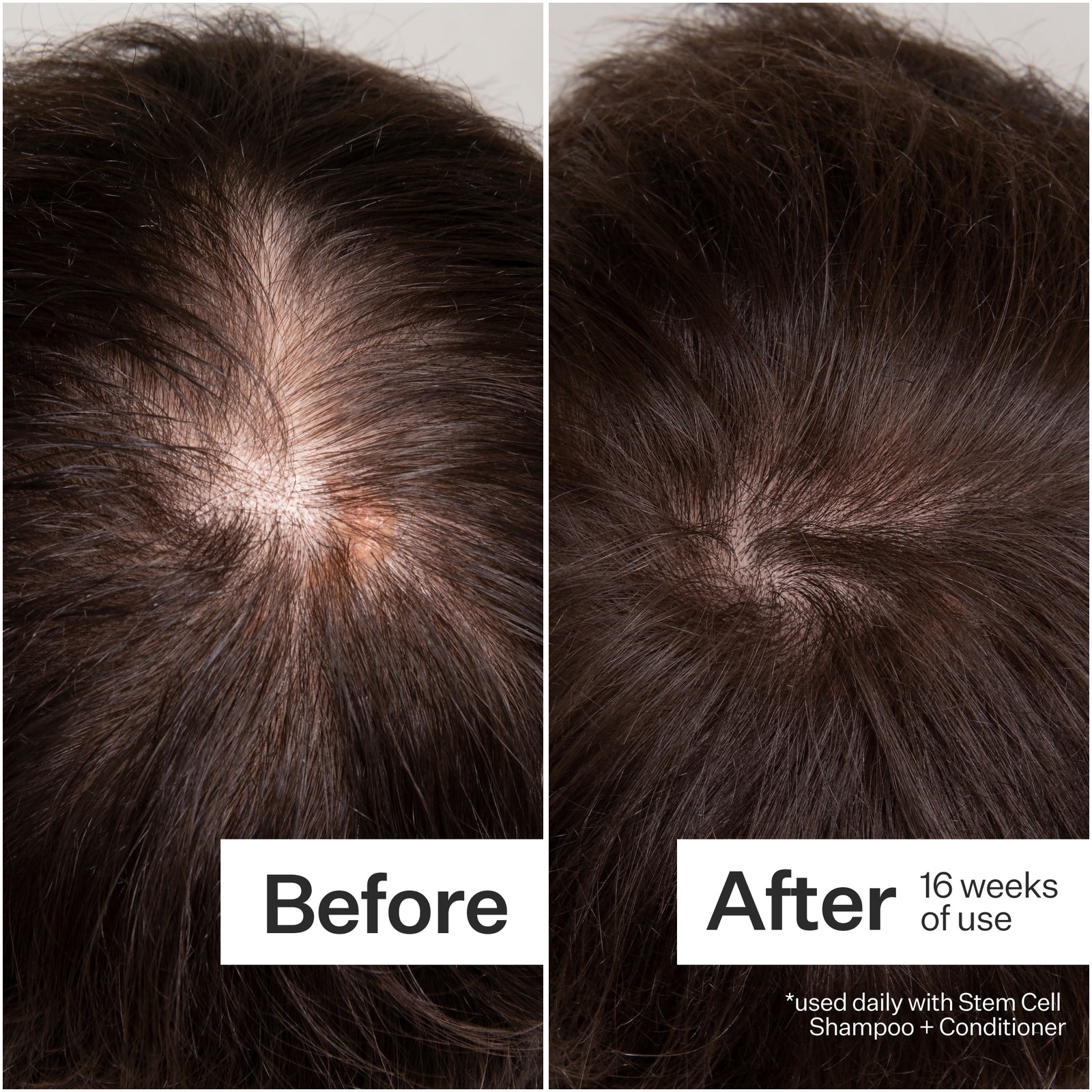 Act+Acre Cold Processed® 3% Stem Cell Peptide Treatment – 3 oz