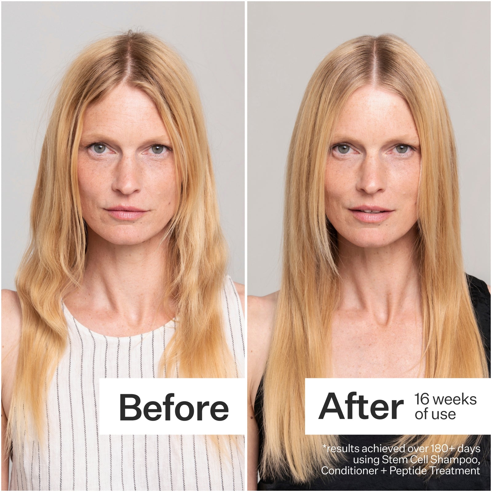 Act+Acre Cold Processed® Shampoing aux cellules souches végétales™ – 295 ml